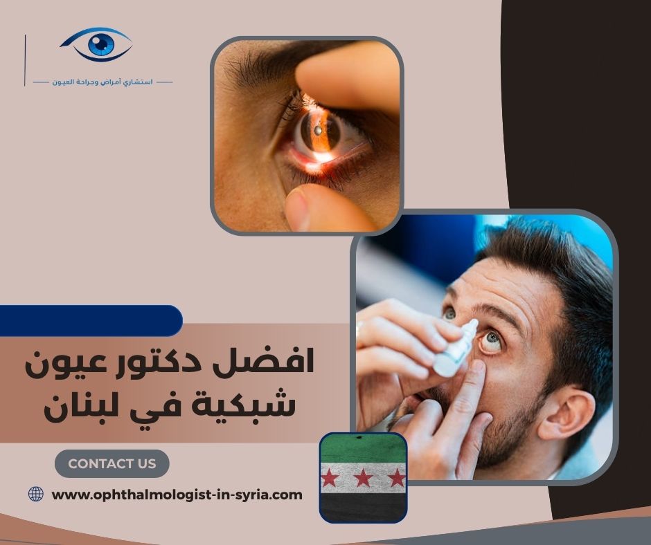 افضل دكتور عيون شبكية في لبنان افضل دكتور عيون شبكية في لبنان