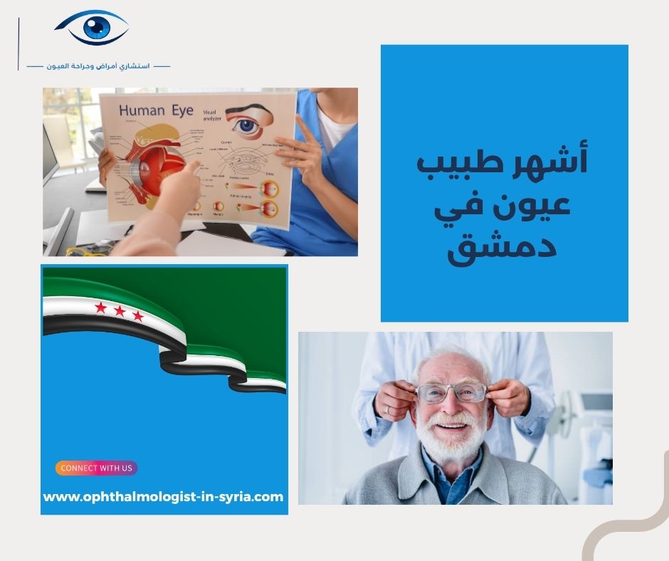 أشهر طبيب عيون في دمشق
