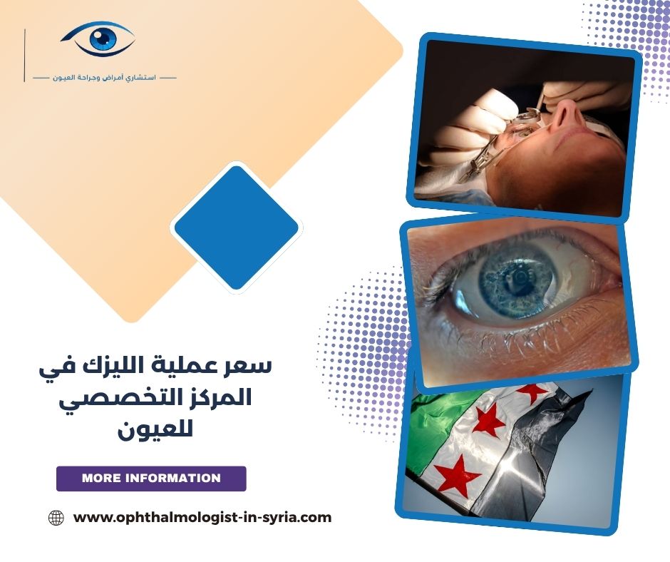سعر عملية الليزك في المركز التخصصي للعيون