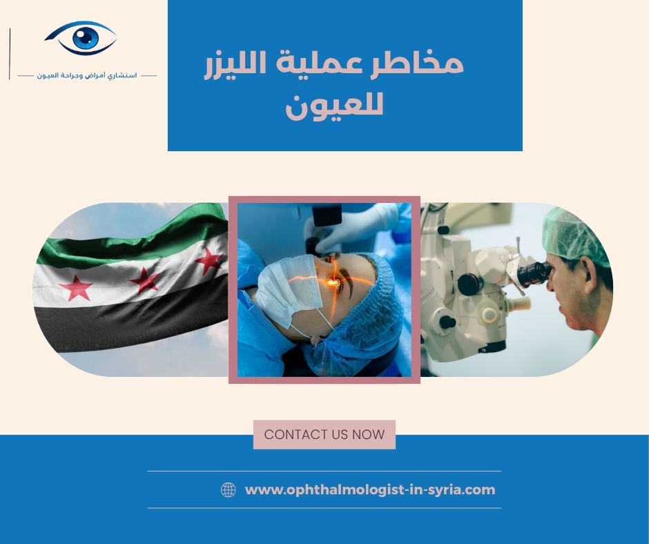 جفاف العين بعد الليزر: متى يكون مؤقتًا ومتى يحتاج متابعة؟ جفاف العين بعد الليزر: متى يكون مؤقتًا ومتى يحتاج متابعة؟