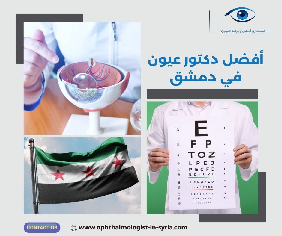 أفضل دكتور عيون في دمشق أفضل دكتور عيون في دمشق