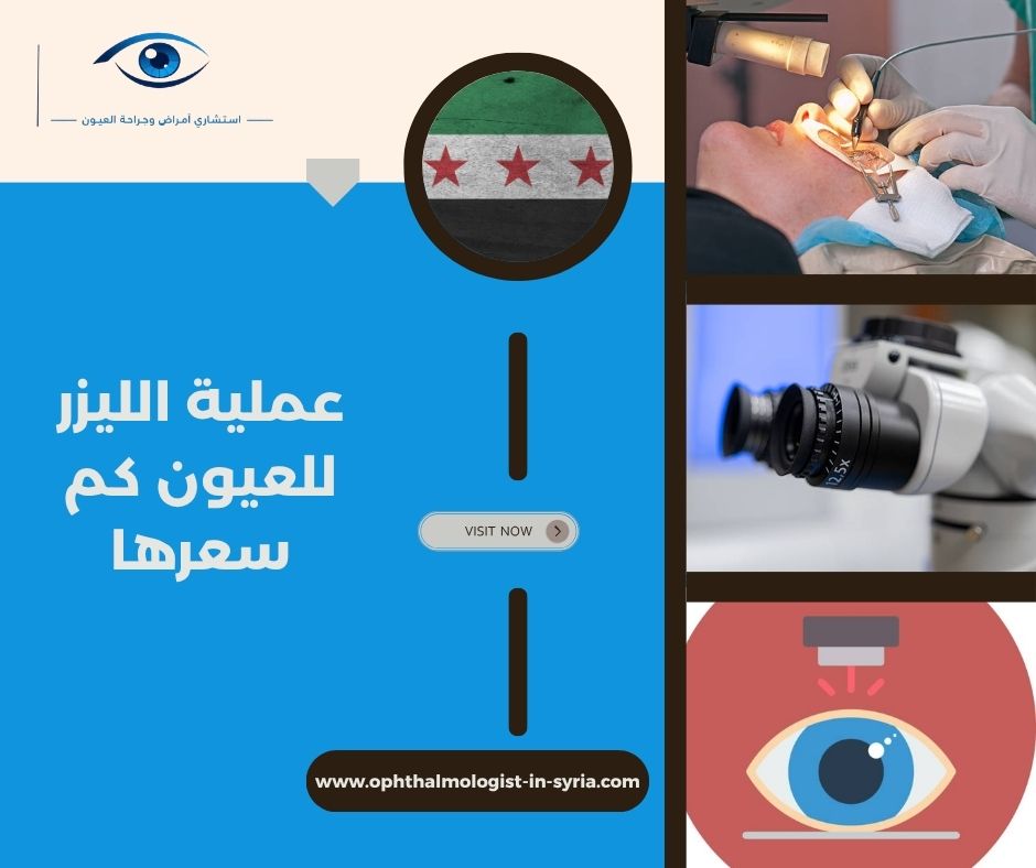 تكلفة عملية الليزر للعيون في دمشق: ما الذي ينبغي السؤال عنه قبل الحجز؟