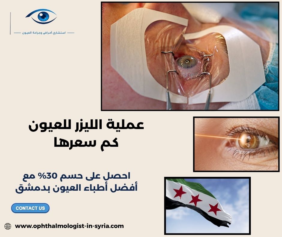 عملية الليزر للعيون كم سعرها