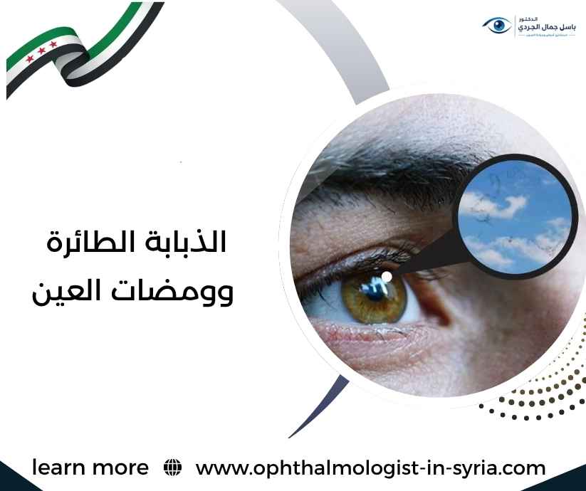الذبابة الطائرة وومضات العين الذبابة الطائرة وومضات العين