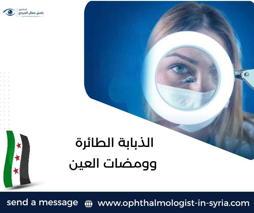 الذبابة الطائرة وومضات العين الذبابة الطائرة وومضات العين
