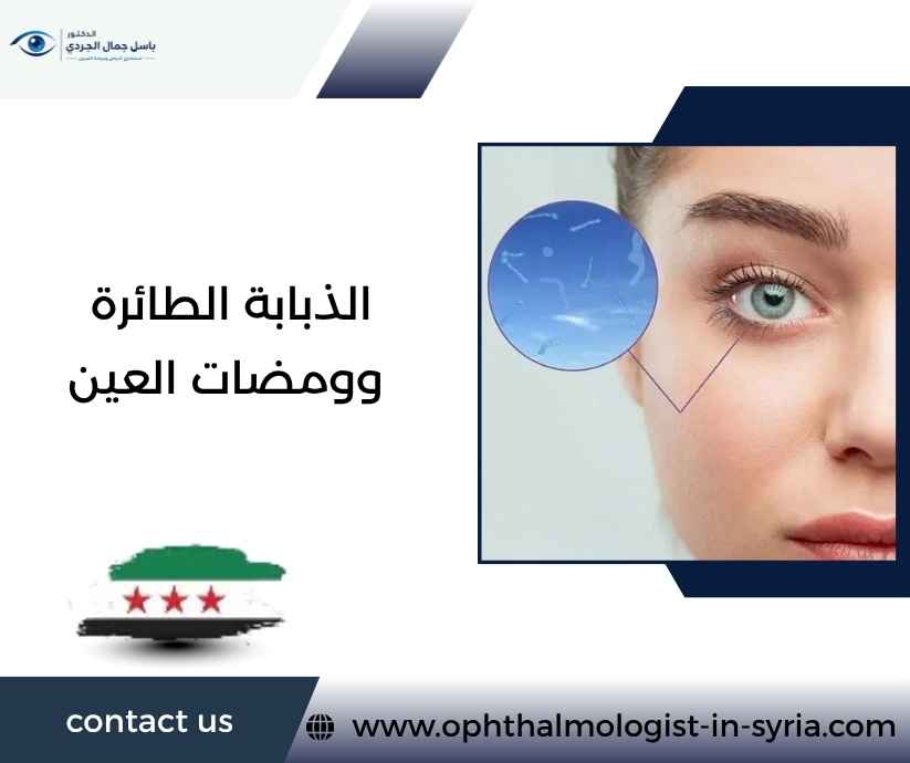الذبابة الطائرة وومضات العين الذبابة الطائرة وومضات العين