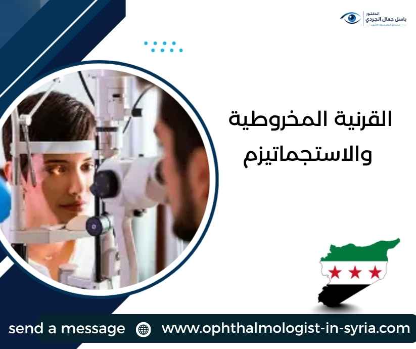 القرنية المخروطية والاستجماتيزم القرنية المخروطية والاستجماتيزم