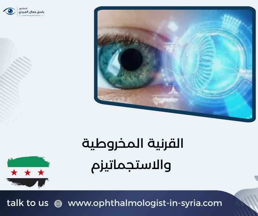 القرنية المخروطية والاستجماتيزم القرنية المخروطية والاستجماتيزم