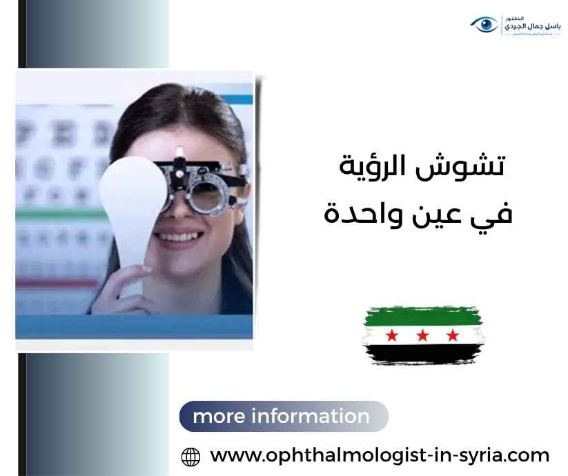 تشوش الرؤية في عين واحدة تشوش الرؤية في عين واحدة