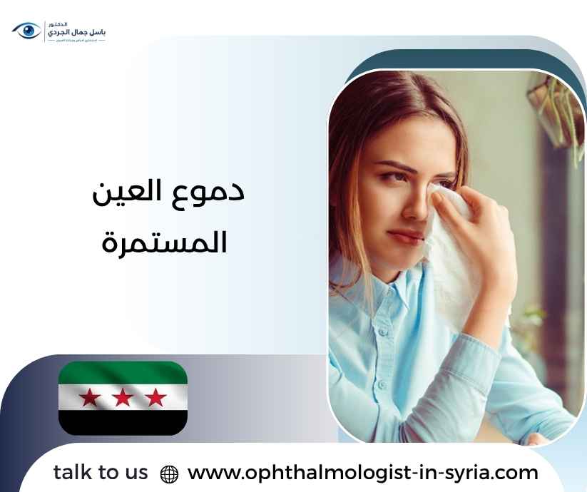 دموع العين المستمرة دموع العين المستمرة