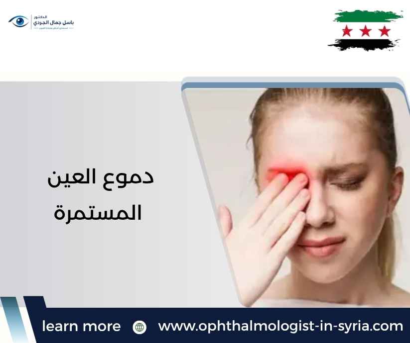 دموع العين المستمرة دموع العين المستمرة