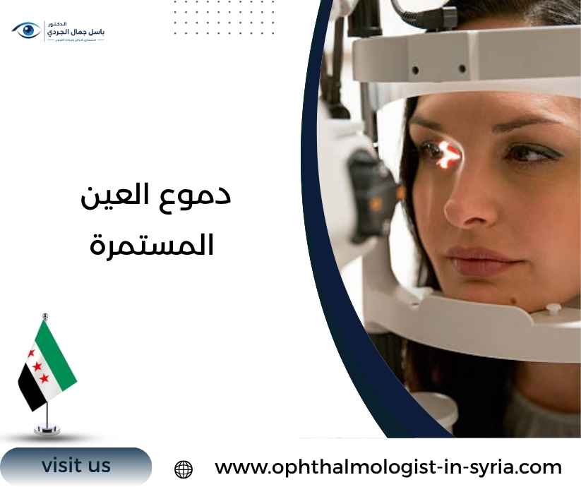 دموع العين المستمرة دموع العين المستمرة